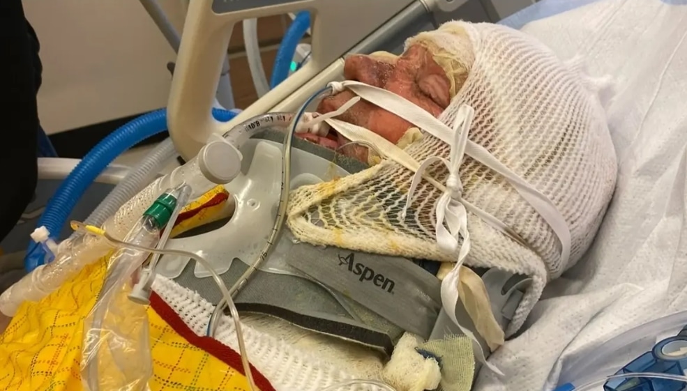 Roofer Electrocuted and Impaled in Freak Accident Roofer electrocuted and impaled